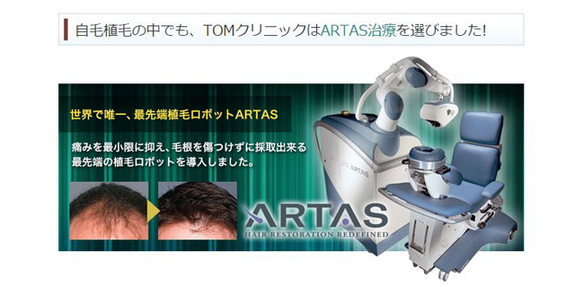 ARTAS（アルタス）